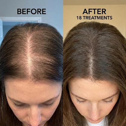 Thicker, Fuller Hair at Home in Just 2 Minutes